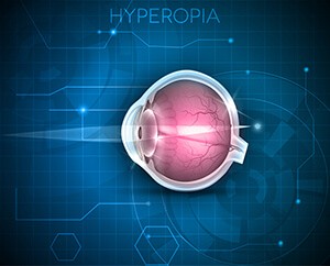 Treating Farsightedness or Hyperopia