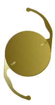 AcrySof Toric Lens Dallas