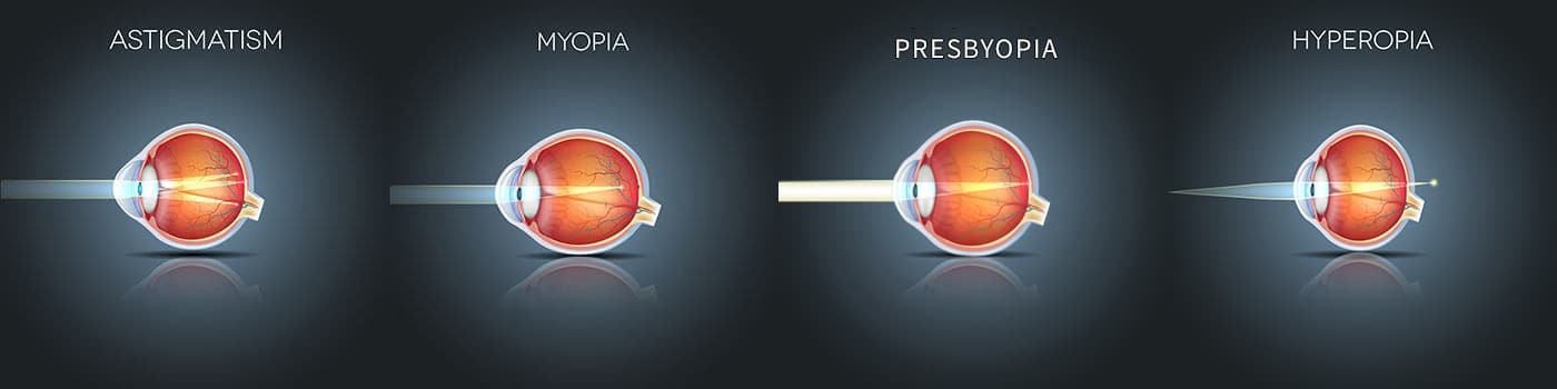 Comprehensive Eye Care Dallas | Eye Conditions Forth Worth, TX